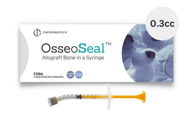 OsseoSeal Mineralized Cortico-Cancellous (50/50) Bone in Syringe [0.3cc]