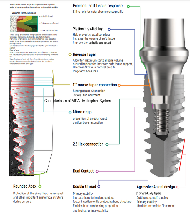 I DO Dental Implant Details